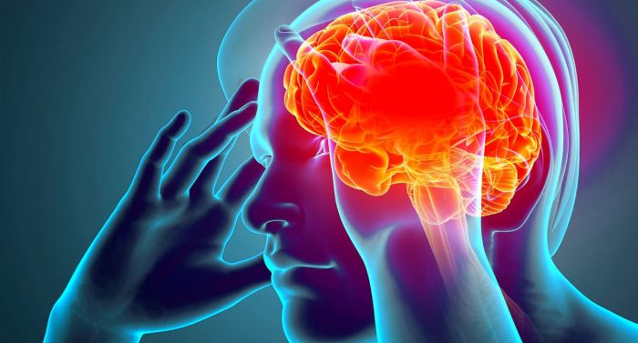 cirurgia-cerebrovascular-blog